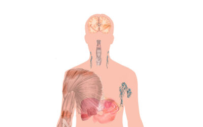 Fibromialgia