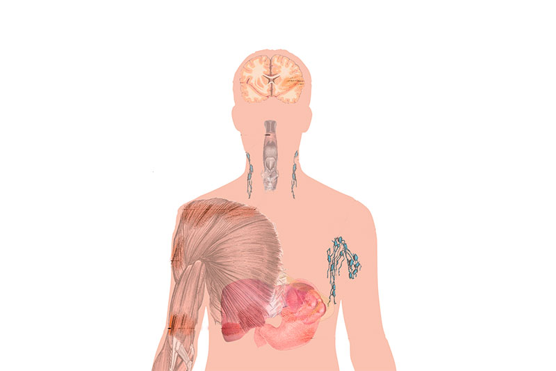 Fibromialgia